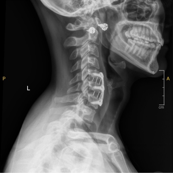 Meet your Posher, Allison - Picture 2 of 3